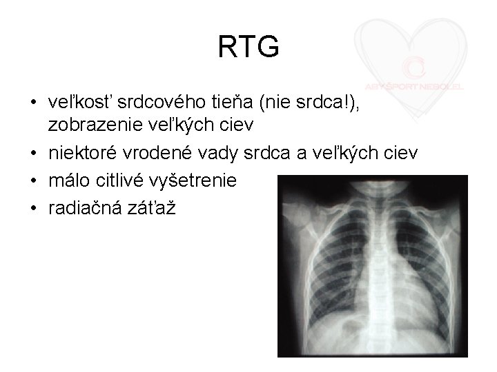 RTG • veľkosť srdcového tieňa (nie srdca!), zobrazenie veľkých ciev • niektoré vrodené vady