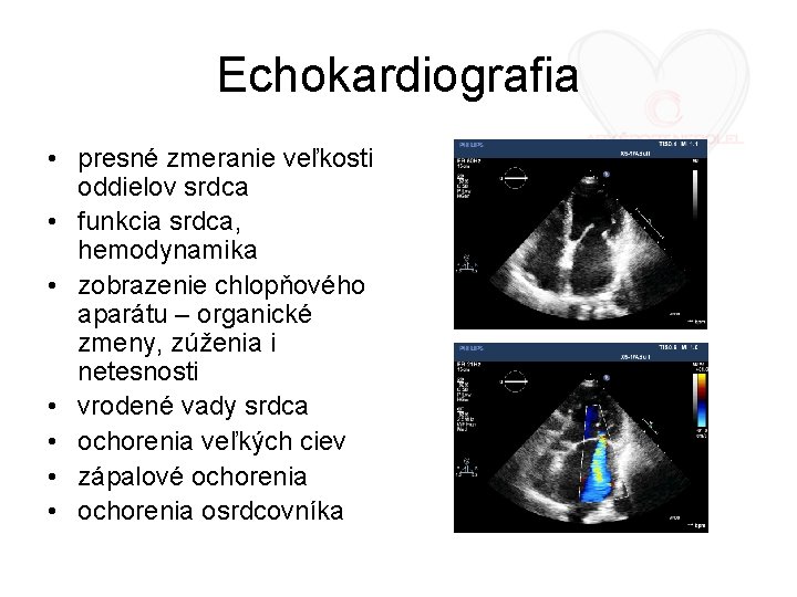 Echokardiografia • presné zmeranie veľkosti oddielov srdca • funkcia srdca, hemodynamika • zobrazenie chlopňového