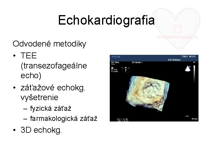Echokardiografia Odvodené metodiky • TEE (transezofageálne echo) • záťažové echokg. vyšetrenie – fyzická záťaž