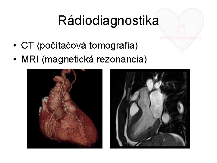 Rádiodiagnostika • CT (počítačová tomografia) • MRI (magnetická rezonancia) 