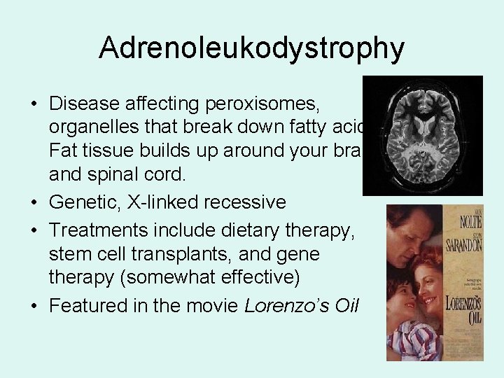 Adrenoleukodystrophy • Disease affecting peroxisomes, organelles that break down fatty acids. Fat tissue builds