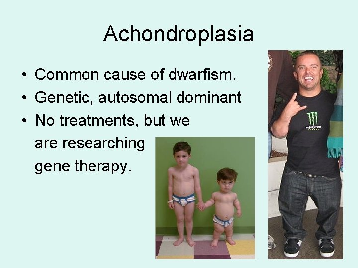 Achondroplasia • Common cause of dwarfism. • Genetic, autosomal dominant • No treatments, but