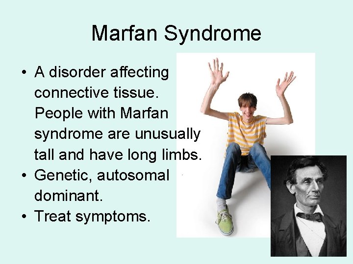 Marfan Syndrome • A disorder affecting connective tissue. People with Marfan syndrome are unusually