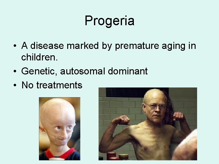Progeria • A disease marked by premature aging in children. • Genetic, autosomal dominant