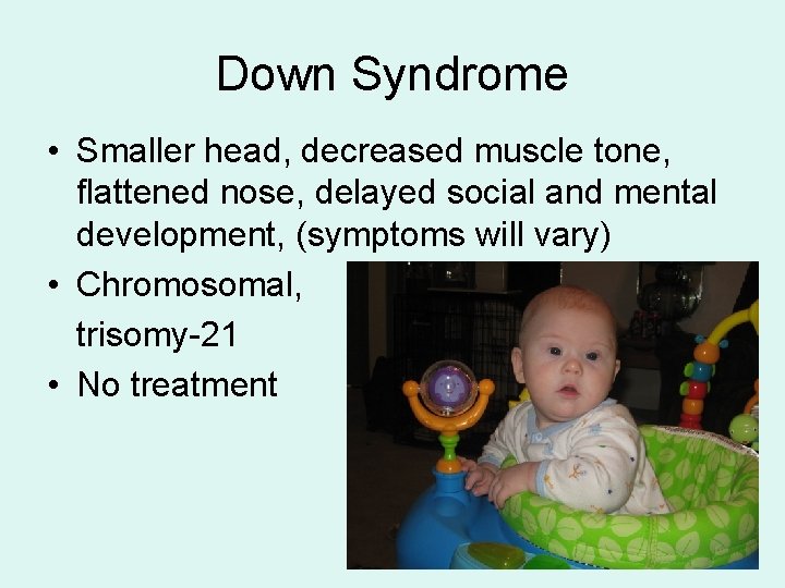 Down Syndrome • Smaller head, decreased muscle tone, flattened nose, delayed social and mental