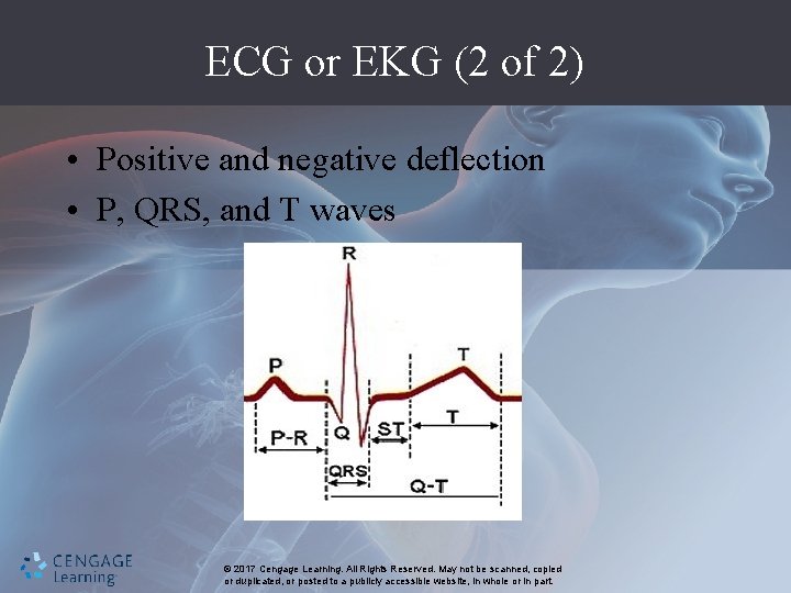 ECG or EKG (2 of 2) • Positive and negative deflection • P, QRS,