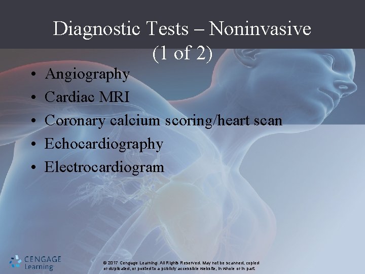 Diagnostic Tests – Noninvasive (1 of 2) • • • Angiography Cardiac MRI Coronary