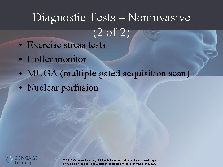 Diagnostic Tests – Noninvasive (2 of 2) • • Exercise stress tests Holter monitor