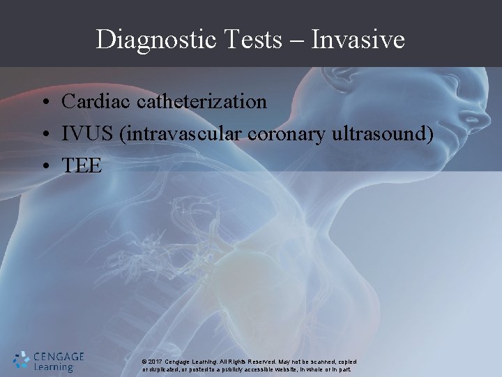 Diagnostic Tests – Invasive • Cardiac catheterization • IVUS (intravascular coronary ultrasound) • TEE