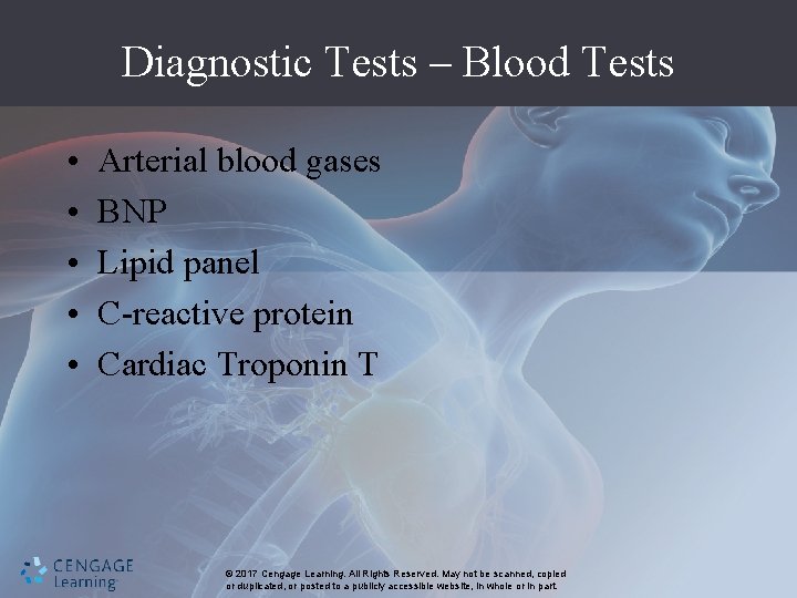 Diagnostic Tests – Blood Tests • • • Arterial blood gases BNP Lipid panel