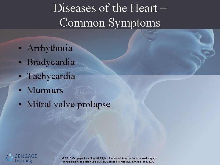 Diseases of the Heart – Common Symptoms • • • Arrhythmia Bradycardia Tachycardia Murmurs