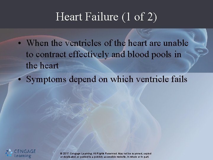 Heart Failure (1 of 2) • When the ventricles of the heart are unable