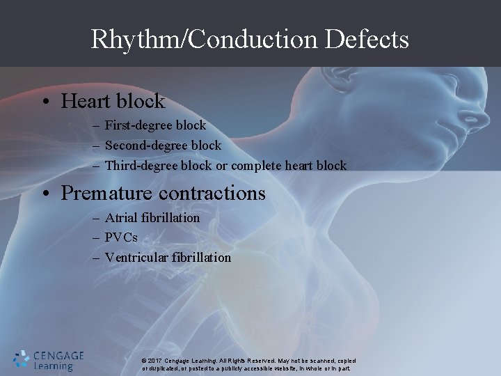 Rhythm/Conduction Defects • Heart block – First-degree block – Second-degree block – Third-degree block