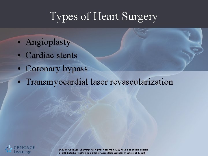 Types of Heart Surgery • • Angioplasty Cardiac stents Coronary bypass Transmyocardial laser revascularization