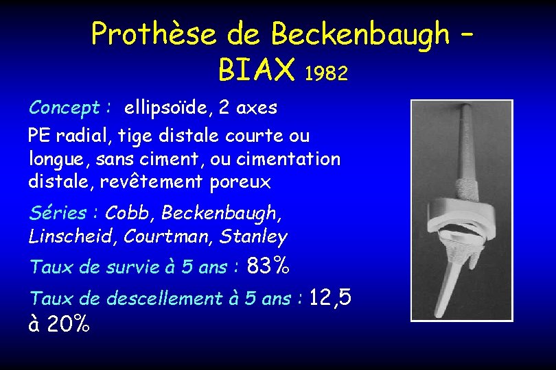 Prothèse de Beckenbaugh – BIAX 1982 Concept : ellipsoïde, 2 axes PE radial, tige