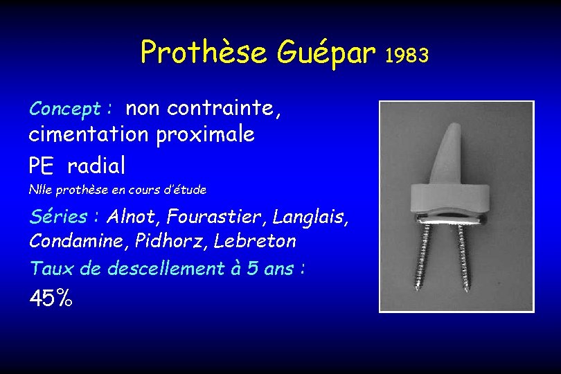 Prothèse Guépar Concept : non contrainte, cimentation proximale PE radial Nlle prothèse en cours