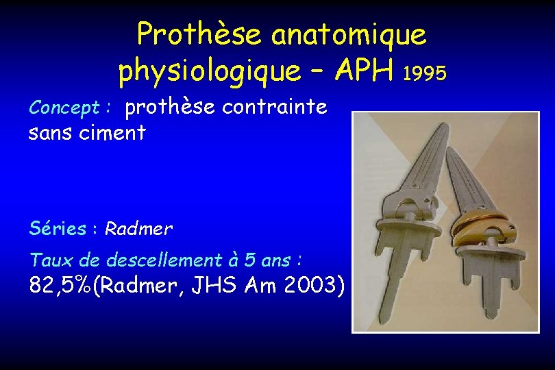 Prothèse anatomique physiologique – APH 1995 Concept : prothèse contrainte sans ciment Séries :