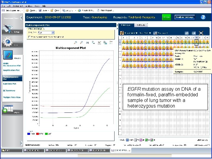 EGFR mutation assay on DNA of a formalin-fixed, paraffin-embedded sample of lung tumor with