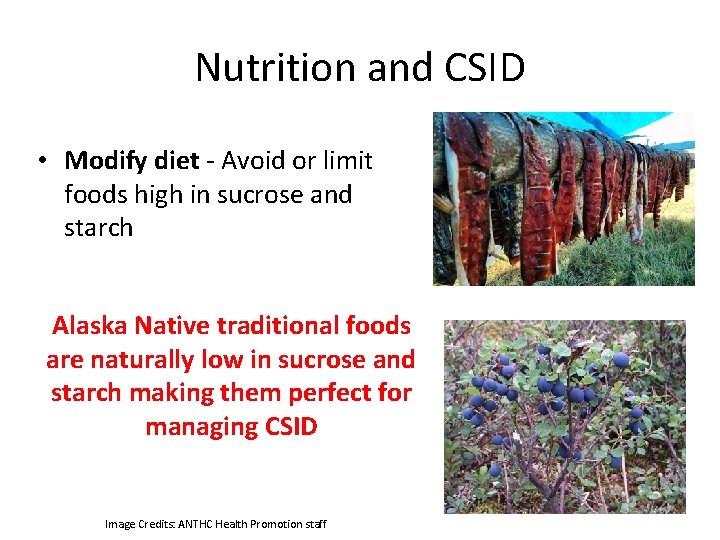 Nutrition and CSID • Modify diet - Avoid or limit foods high in sucrose