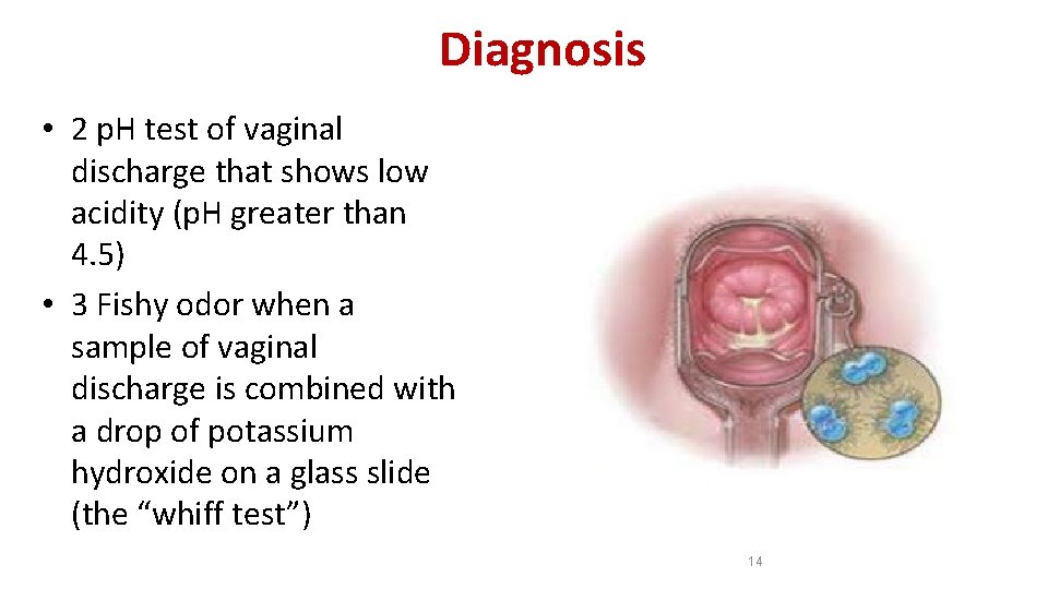 Diagnosis • 2 p. H test of vaginal discharge that shows low acidity (p.