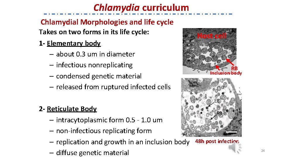 Chlamydia curriculum Chlamydial Morphologies and life cycle Takes on two forms in its life