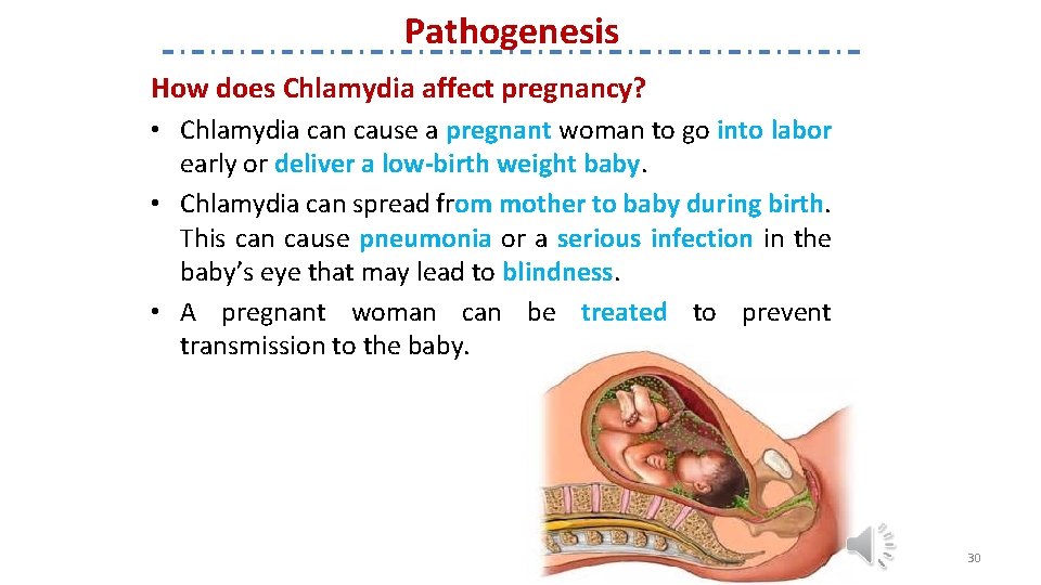 Pathogenesis How does Chlamydia affect pregnancy? • Chlamydia can cause a pregnant woman to