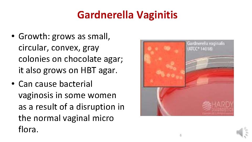 Gardnerella Vaginitis • Growth: grows as small, circular, convex, gray colonies on chocolate agar;