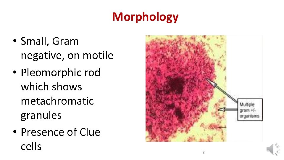 Morphology • Small, Gram negative, on motile • Pleomorphic rod which shows metachromatic granules