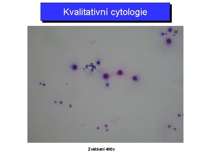 Kvalitativní cytologie Zvětšení 400 x 