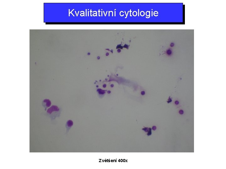 Kvalitativní cytologie Zvětšení 400 x 