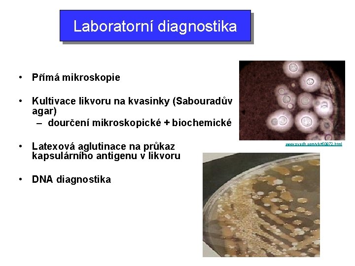 Laboratorní diagnostika • Přímá mikroskopie • Kultivace likvoru na kvasinky (Sabouradův agar) – dourčení