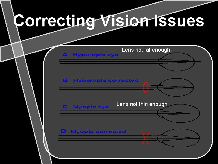 Correcting Vision Issues Lens not fat enough Lens not thin enough 