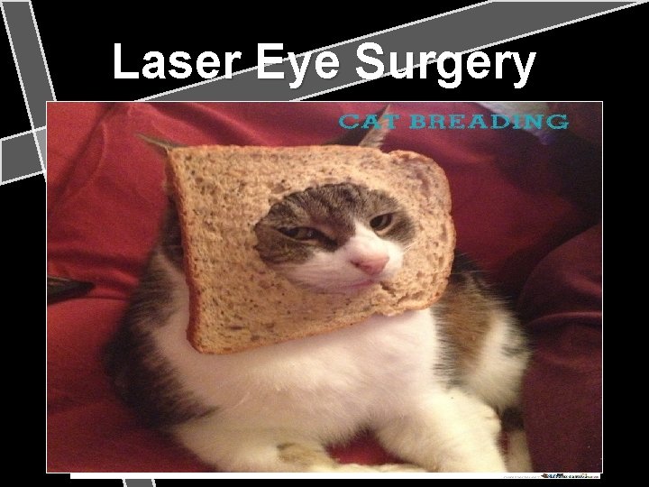 Laser Eye Surgery 