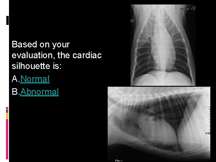 Based on your evaluation, the cardiac silhouette is: A. Normal B. Abnormal 