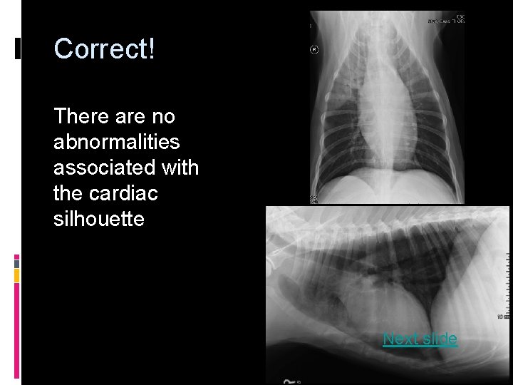 Correct! There are no abnormalities associated with the cardiac silhouette Next slide 