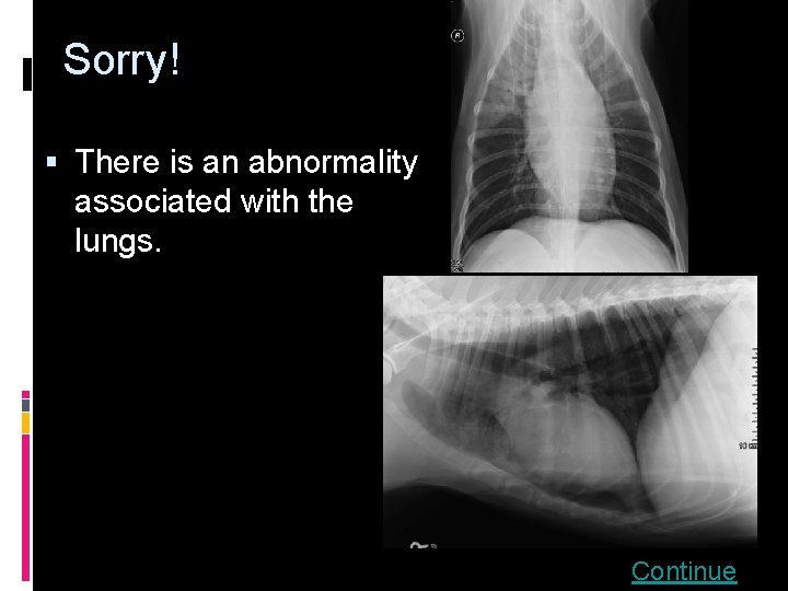 Sorry! § There is an abnormality associated with the lungs. Continue 