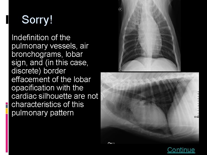 Sorry! Indefinition of the pulmonary vessels, air bronchograms, lobar sign, and (in this case,