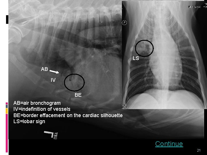 LS AB IV BE AB=air bronchogram IV=indefinition of vessels BE=border effacement on the cardiac