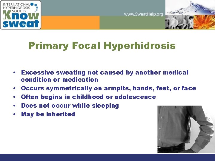 Primary Focal Hyperhidrosis • Excessive sweating not caused by another medical condition or medication
