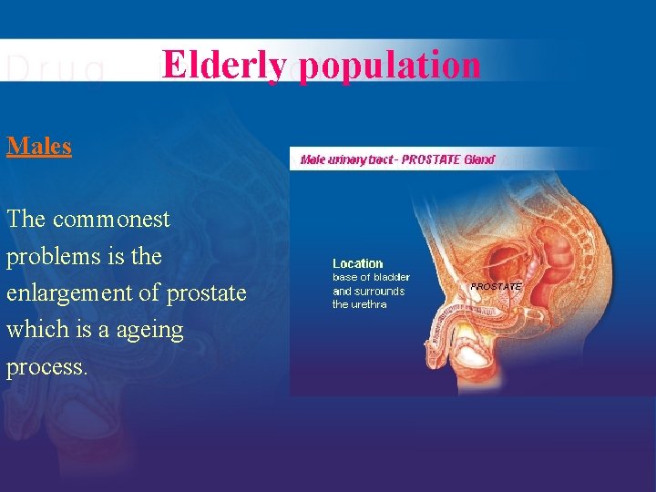 Elderly population Males The commonest problems is the enlargement of prostate which is a
