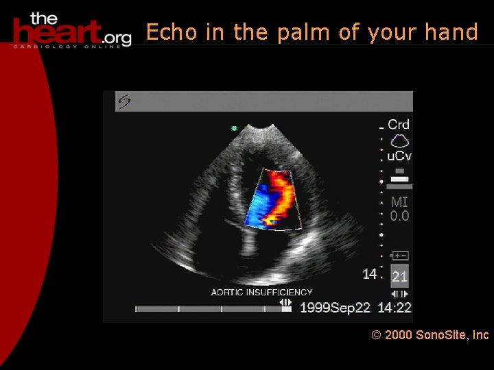 Echo in the palm of your hand © 2000 Sono. Site, Inc 
