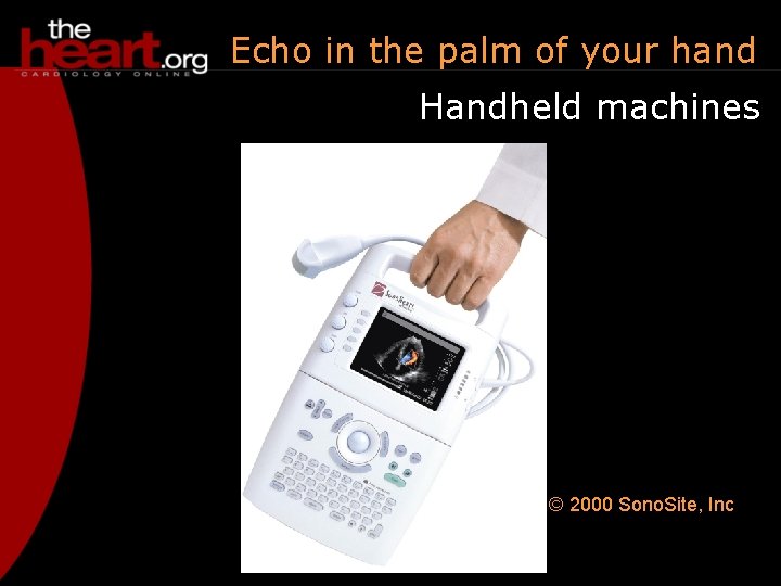 Echo in the palm of your hand Handheld machines © 2000 Sono. Site, Inc