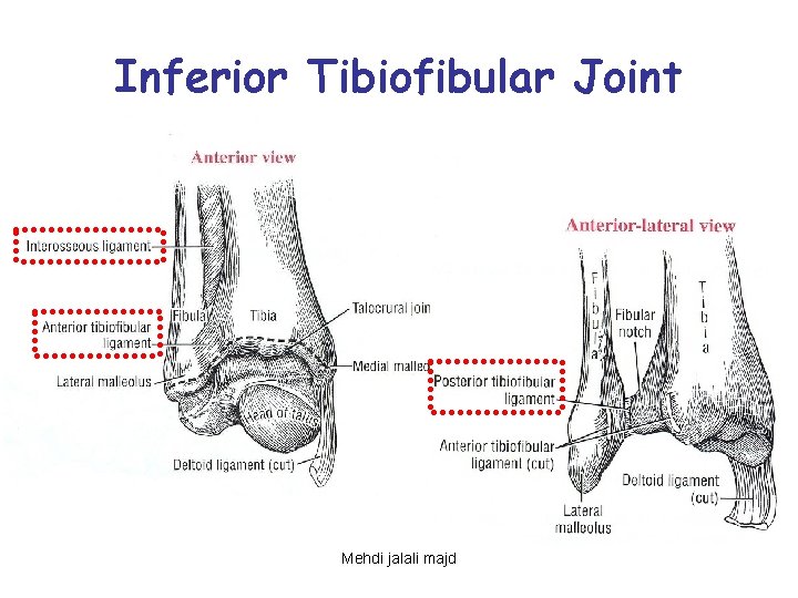 Inferior Tibiofibular Joint Mehdi jalali majd 