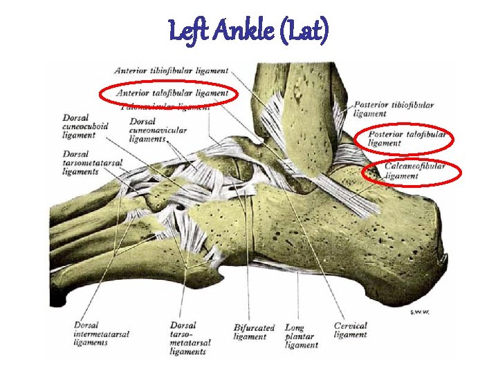 Left Ankle (Lat) Mehdi jalali majd 