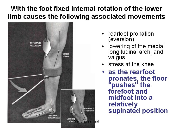 With the foot fixed internal rotation of the lower limb causes the following associated