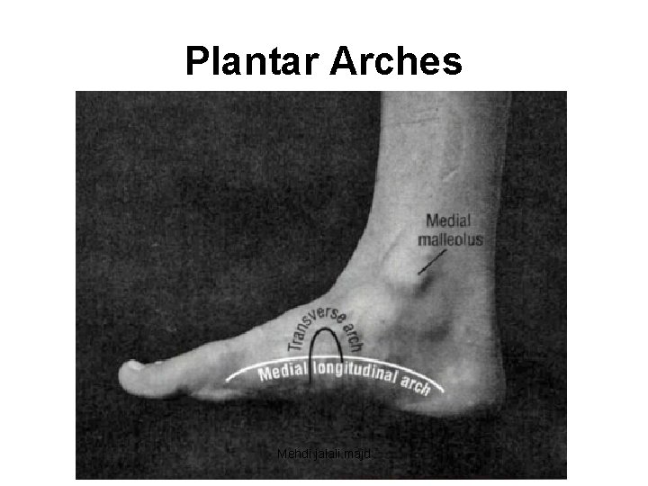 Plantar Arches Mehdi jalali majd 