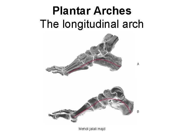 Plantar Arches The longitudinal arch Mehdi jalali majd 