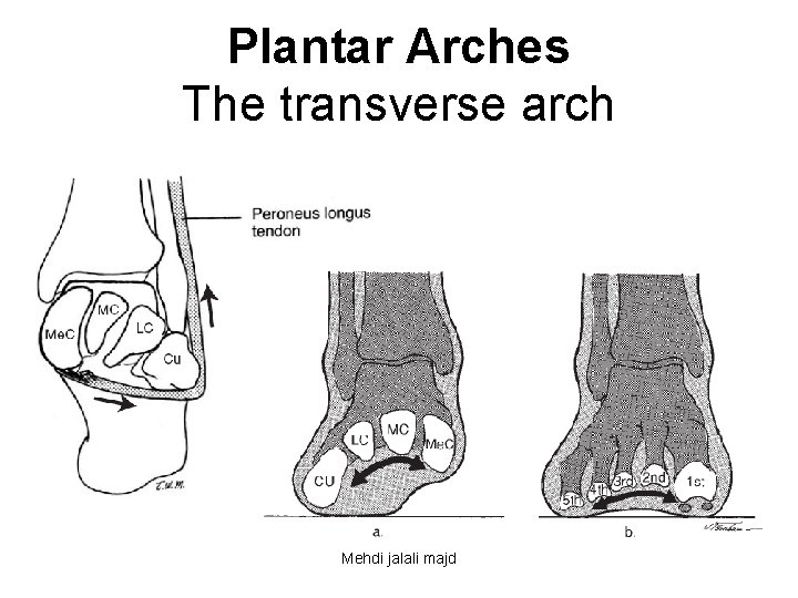 Plantar Arches The transverse arch Mehdi jalali majd 