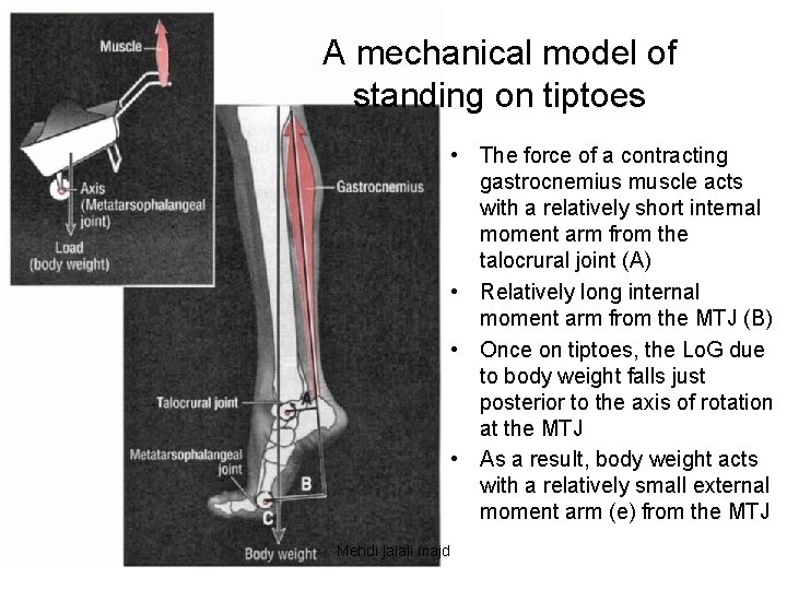 A mechanical model of standing on tiptoes • The force of a contracting gastrocnemius