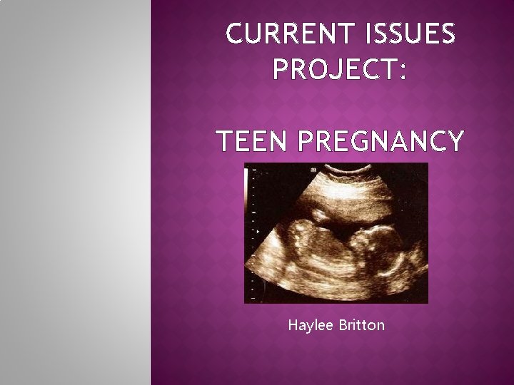 CURRENT ISSUES PROJECT: TEEN PREGNANCY Haylee Britton 